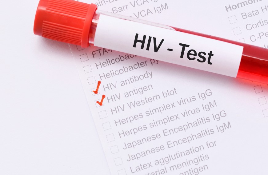 Understanding HIV testing locations and the importance of knowing one's HIV status are crucial in the fight against the HIV epidemic. Antiretroviral therapy plays a significant role in reducing HIV transmission and managing the virus. Combating HIV-related stigma through HIV education programs and community health initiatives is essential for effective HIV prevention strategies. Access to HIV support services further empowers individuals living with HIV to manage their health and well-being.National HIV Testing Day highlights the need for testing and raising HIV awareness. This annual observance underscores the importance of regular HIV testing, which is crucial for early detection and effective management of the virus. Early detection through routine testing allows individuals to seek timely treatment and make informed decisions about their health. In regions like South Florida, where HIV prevalence is notably high, such initiatives are particularly vital.